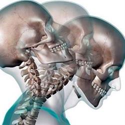 The Brain Injury Association of New Zealand - Central Districts Office