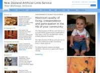 Artificial Limb Centre