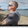 Scalp MicroPigmentation Auckland - Melissa Carr Cosmetic Tattoo