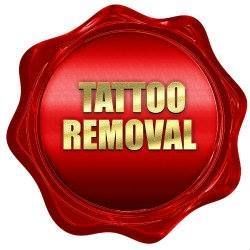 DeINK Tattoo Removal