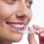 Invisalign Tauranga