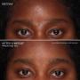 # 7