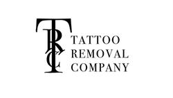 Tattoo Removal Company