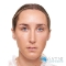 After Dermal Filler, Olivier