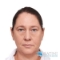 Before Dermal Filler, Nicole