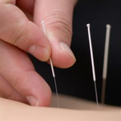 Superior Acupuncture Clinic