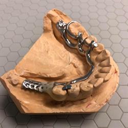 Dynamic Dentures