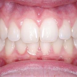 Paul Crowther Orthodontics
