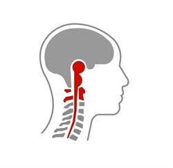 Headache & Neck Clinic