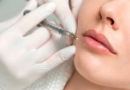 Lip injections West Auckland